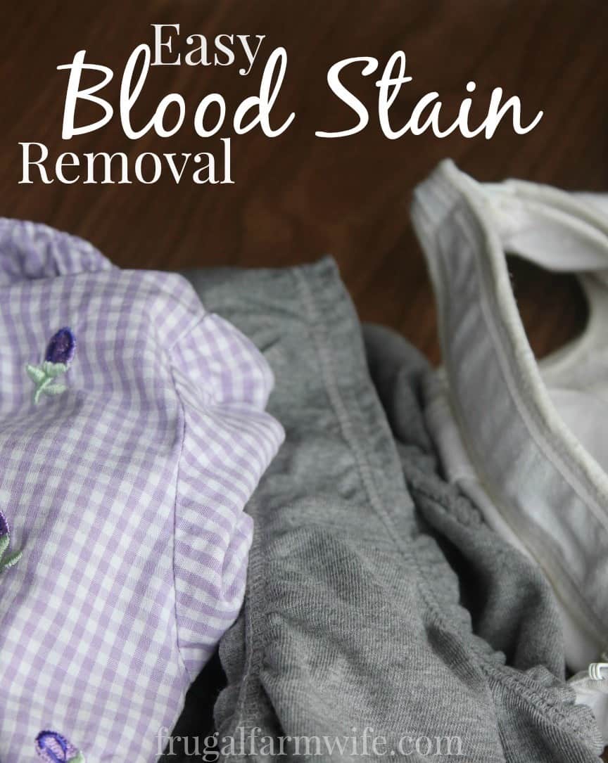 How To Remove Bloodstains From Clothing