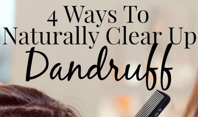 Four Ways To Naturally Clear Up Dandruff